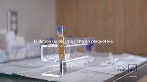 Plasma riche en plaquettes