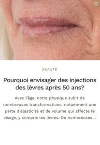 injection lèvres 50 ans